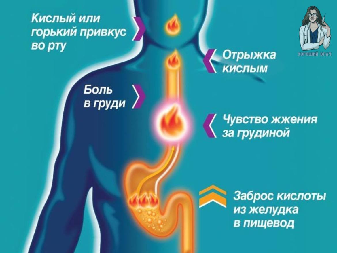 Не восстанавливается стул после антибиотиков